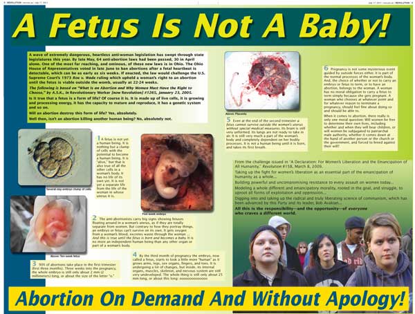 A fetus is not a baby