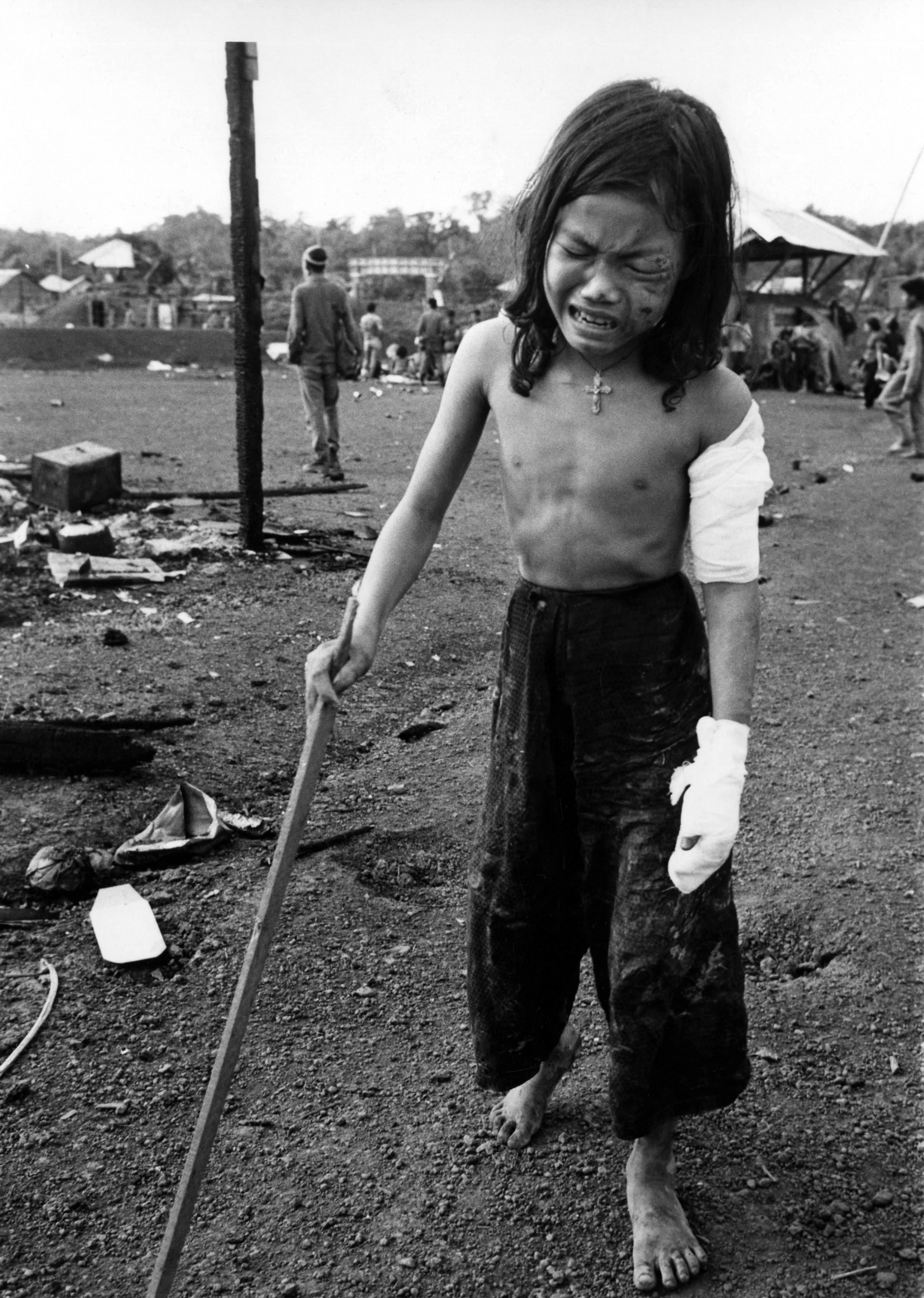 Little girl injured and orphaned in attack by U.S. and South Vietnamese troops