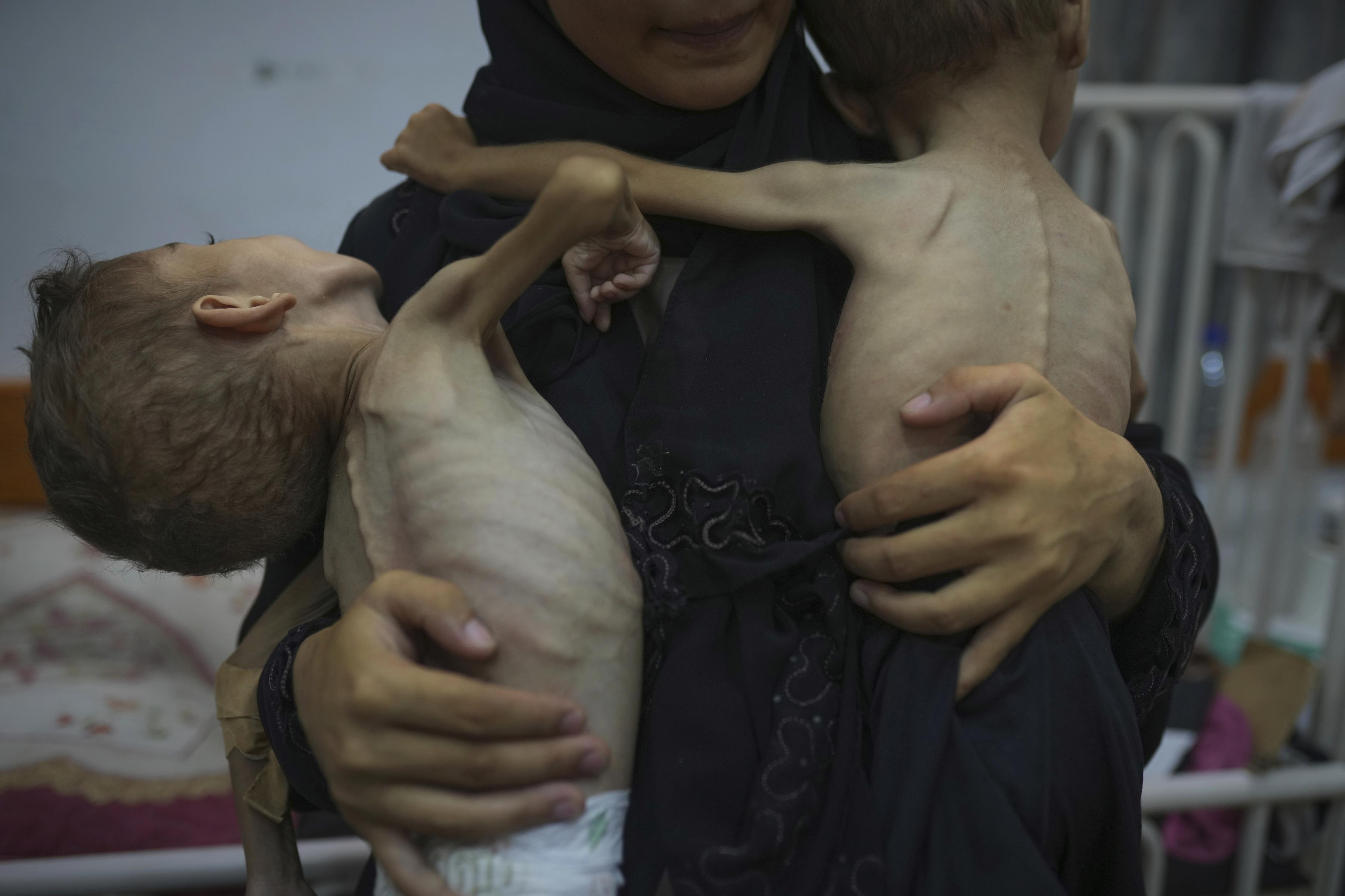 Palestinian mother holds her malnourished sons, 4 and 3 years old, at Friends of the Patient Hospital in Gaza City, July 29, 2025.