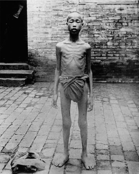 Circa 1907, this famine victim in China became a beggar on the street.