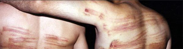 Iranian political prisoners tortured by beatings