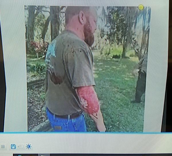 Police video cam of Travis McMichael who's arm is covered with Ahmaud Arbery's blood.