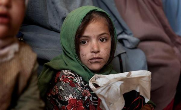Young girl in Afghanistan waits for food.
