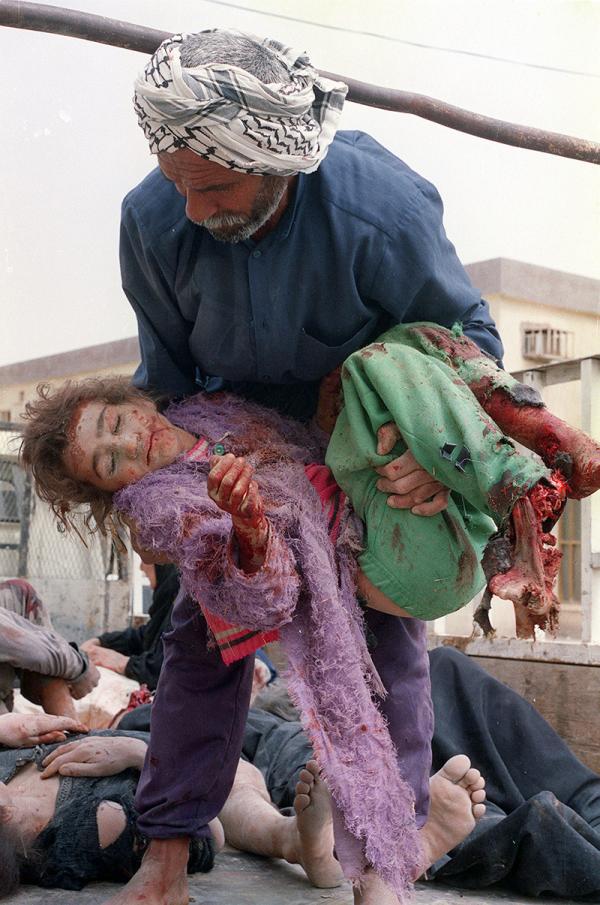 Iraq, 9-year-old girl carried by her uncle, injured from U.S. bombing, March 22, 2003.