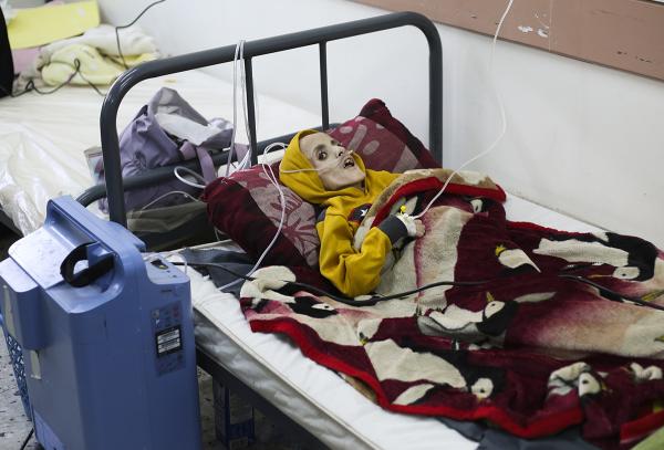 A 10-year-old Palestinian boy, Yazan al-Kafarna, in hospital bed in Rafah, died due to what his doctor said was extreme muscle wastage caused primarily by a lack of food.