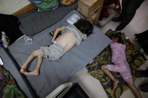 Gaza, children suffer from malnutrition after being displaced, June 1, 2024.