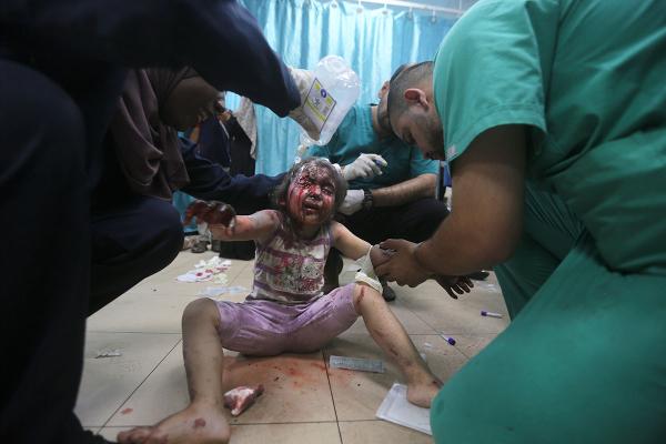 Palestinian child wounded in the Israeli bombardment of the Gaza Strip is treated at al-Aqsa Hospital in Deir al-Balah, June 8, 2024