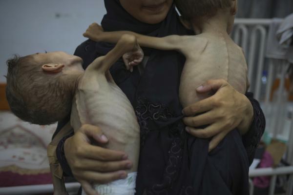 Palestinian mother holds her malnourished sons, 4 and 3 years old, at Friends of the Patient Hospital in Gaza City, July 29, 2025.