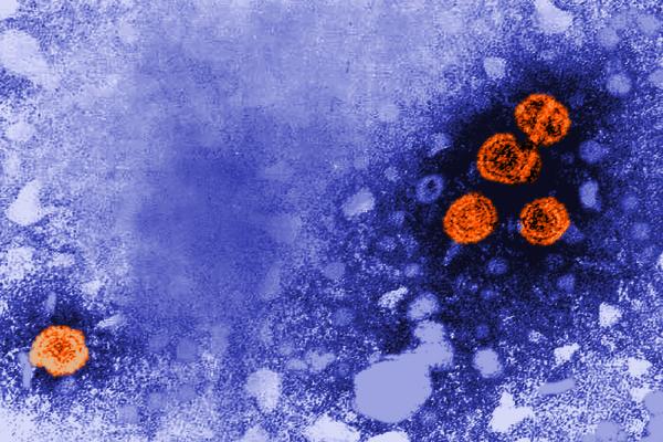 1981 electron microscope image of Hepatitis B virus particles indicated in orange (from the USCDC).