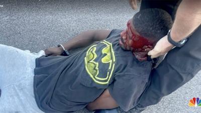 Brandon Calloway, beaten and tazed by police