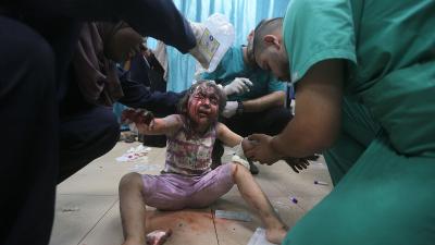 Palestinian child wounded in the Israeli bombardment of the Gaza Strip is treated at al-Aqsa Hospital in Deir al-Balah, June 8, 2024