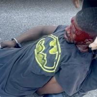 Brandon Calloway, beaten and tazed by police