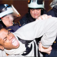 An estimated 250,000 people—a quarter of a million!—suffer injuries at the hands of the cops, with 85,000 requiring hospital treatment.