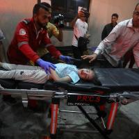 On April 19, 2024, an Israeli strike on a house in Rafah killed at least 10 people, including six children, according to hospital authorities. Child who was hit is being brought on stretcher.