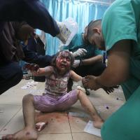 Palestinian child wounded in the Israeli bombardment of the Gaza Strip is treated at al-Aqsa Hospital in Deir al-Balah, June 8, 2024